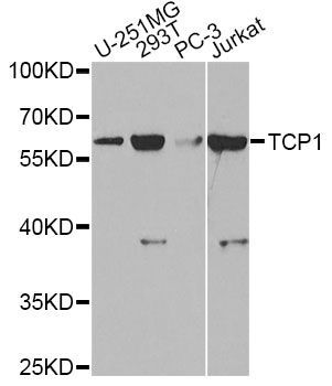 Western blot - TCP1 antibody (144-60306)
