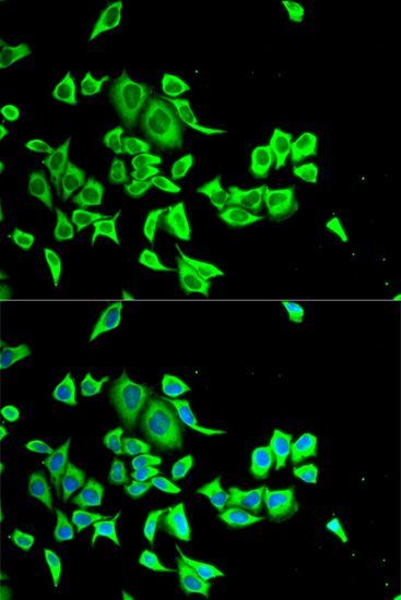 Immunofluorescence - SERPINB1 antibody (144-06257)