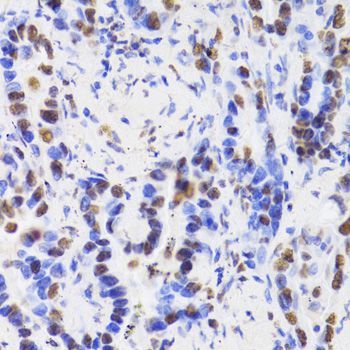 Immunohistochemistry - HDGF Antibody (144-05347)