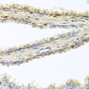 Immunohistochemistry - GPLD1 Polyclonal Antibody (144-06612)