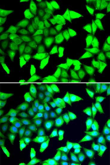 Immunofluorescence - HDAC5 antibody (144-07189)