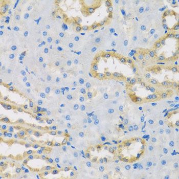 Immunohistochemistry - HS1BP3 antibody (144-08250)