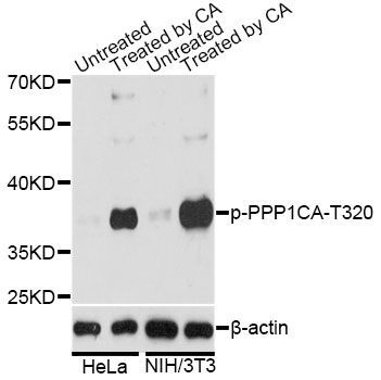 Western blot - Phospho-PPP1CA-T320 pAb (144-61520)