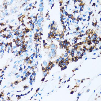 Immunohistochemistry - SPN antibody (144-06412)