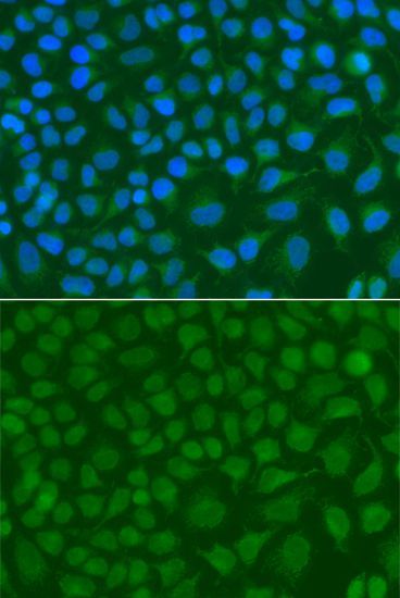 Immunofluorescence - SSX5 antibody (144-07732)