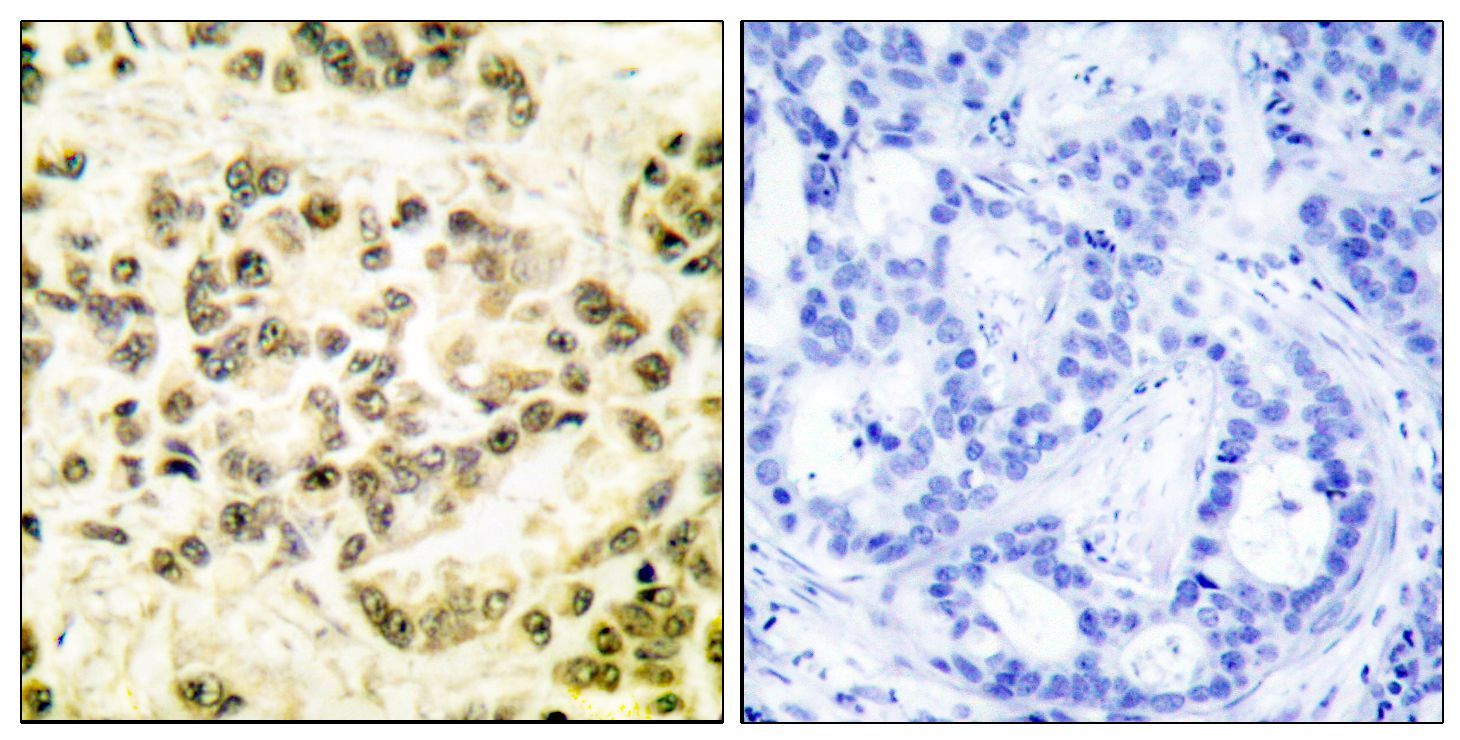 IHC