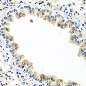 Immunohistochemistry - BMP5 Polyclonal Antibody (144-08401)