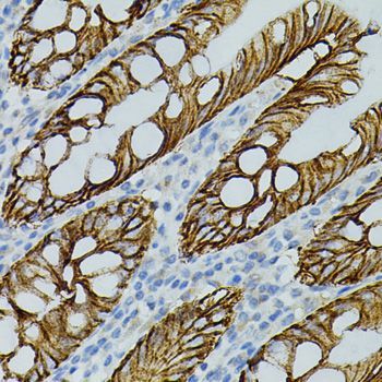 Immunohistochemistry - CLDN3 antibody (144-02946)