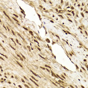 Immunohistochemistry - ANP32A Antibody (144-05768)