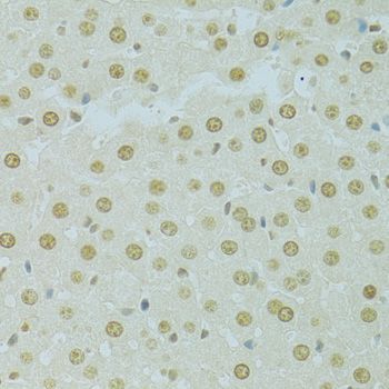 Immunohistochemistry - RCC1 Polyclonal Antibody (144-06350)