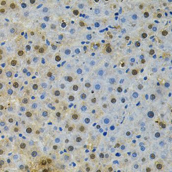 Immunohistochemistry - BUB1 Antibody (144-01929)