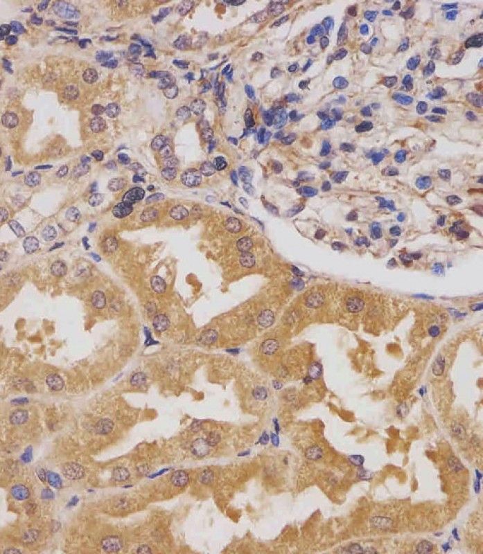 IHC-P