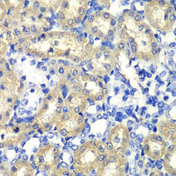 Immunohistochemistry - ABAT antibody (144-05299)