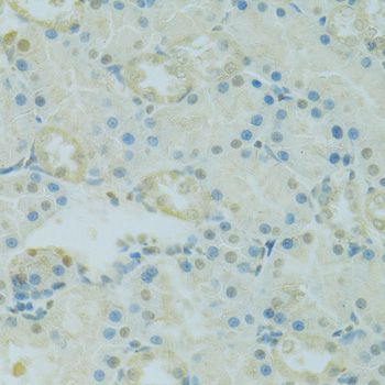Immunohistochemistry - PHOX2B antibody (144-09685)