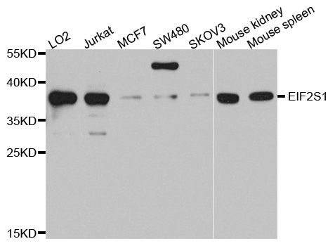 Western blot - EIF2S1 Polyclonal Antibody (144-00764)