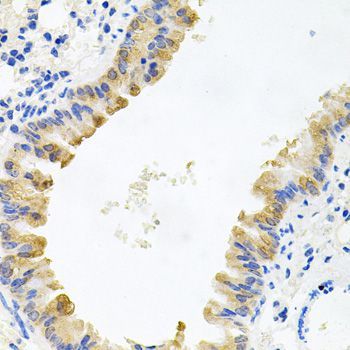 Immunohistochemistry - ALKBH8 antibody (144-07142)