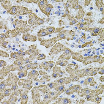 Immunohistochemistry - PHF1 antibody (144-08450)