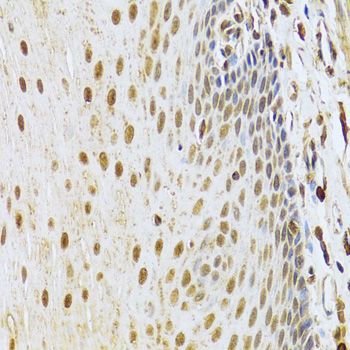Immunohistochemistry - CDK4 Polyclonal Antibody (144-00366)