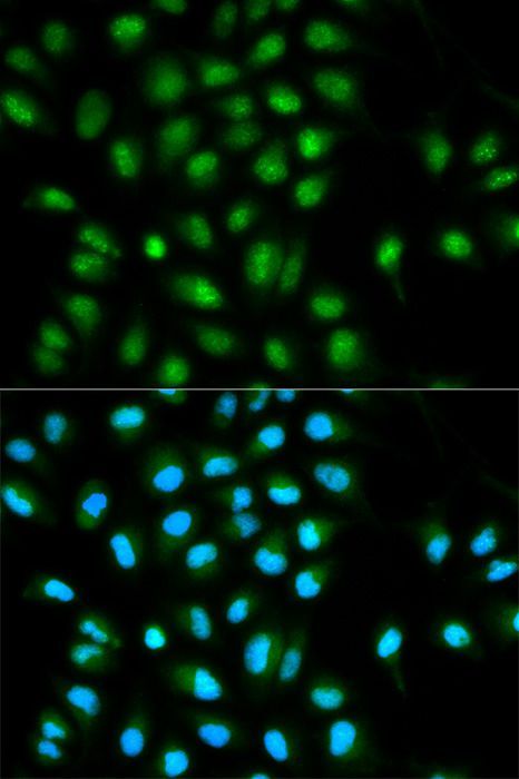 Immunofluorescence - PYCARD antibody (144-01170)