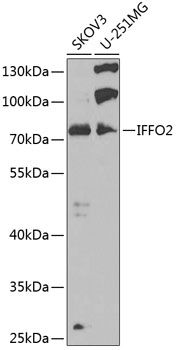 Western blot