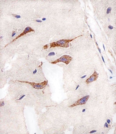 IHC-P