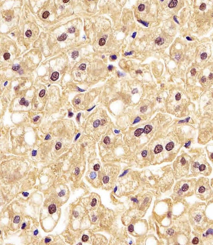 IHC-P