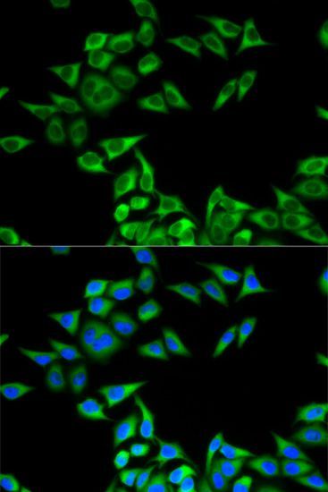 Immunofluorescence - CHMP2B antibody (144-013410)