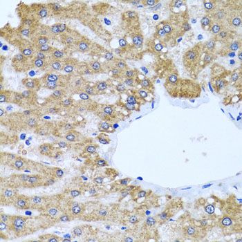Immunohistochemistry - CCM2 antibody (144-06544)