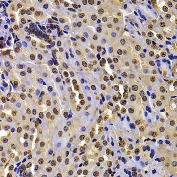 Immunohistochemistry - WHSC1 Polyclonal Antibody (144-07938)