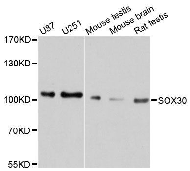 Western blot - SOX30 antibody (144-011715)