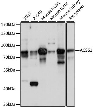 Western blot - ACSS1 antibody (144-60881)