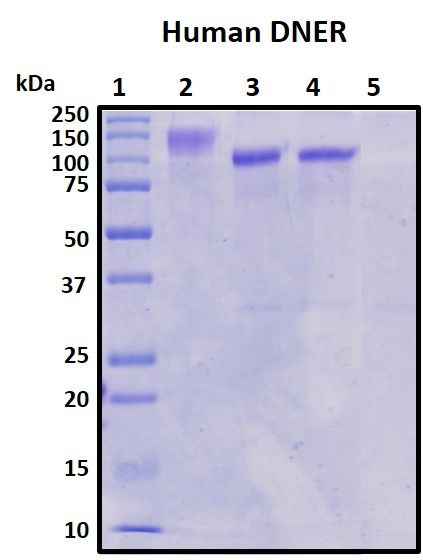 SDS-PAGE