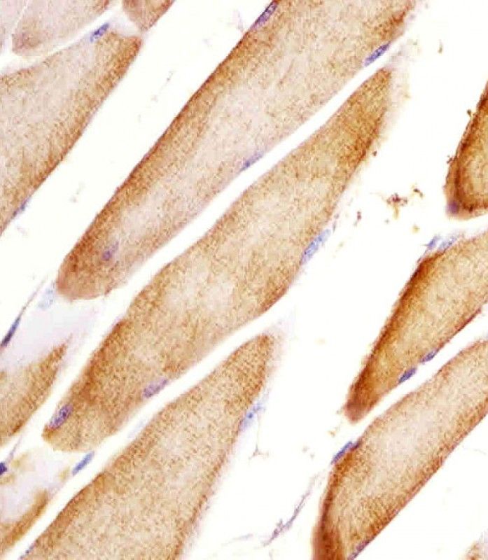IHC-P