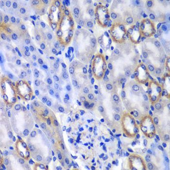 Immunohistochemistry - MATK antibody (144-06651)