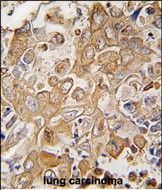 IHC-P