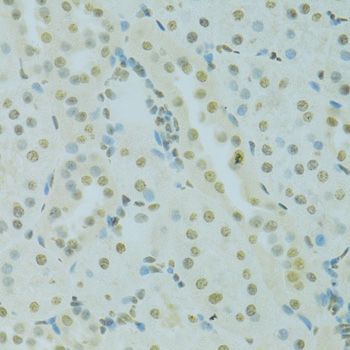 Immunohistochemistry - SAFB antibody (144-07927)