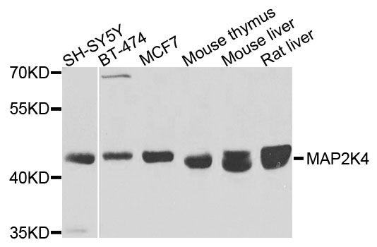 Western blot - [KO Validated] MAP2K4 Polyclonal Antibody (144-60791)