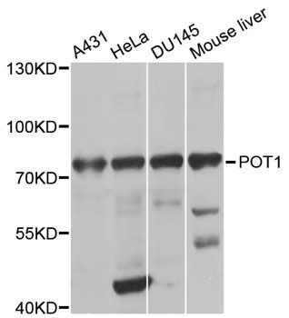 Western blot - POT1 antibody (144-01491)