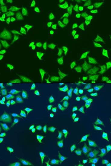 Immunofluorescence - SMN2 antibody (144-12508)