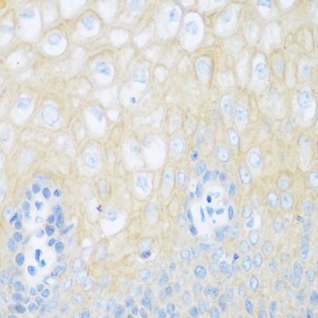 Immunohistochemistry - CDH1 Polyclonal Antibody (144-011492)