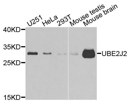 Western blot - UBE2J2 antibody (144-07316)