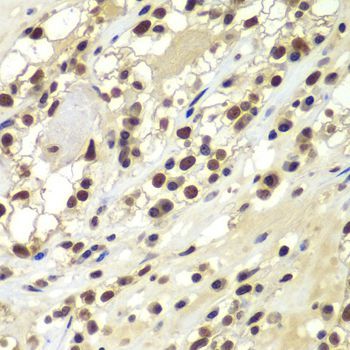 Immunohistochemistry - PRKDC Polyclonal Antibody (144-07716)