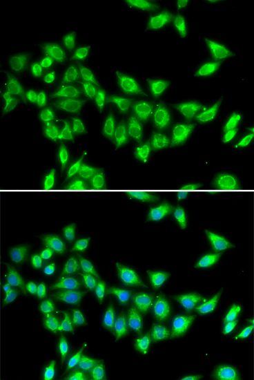 Immunofluorescence - KIF3A Polyclonal Antibody (144-06639)