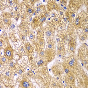 Immunohistochemistry - RPN1 antibody (144-06726)