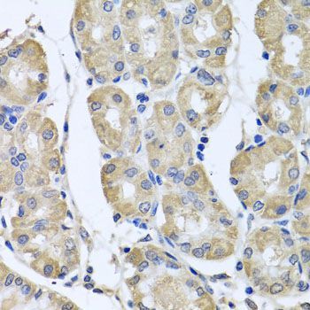 Immunohistochemistry - BAG5 antibody (144-05794)