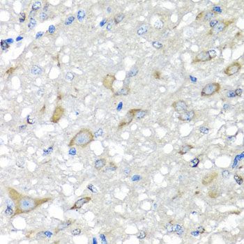 Immunohistochemistry - CBR3 antibody (144-07545)