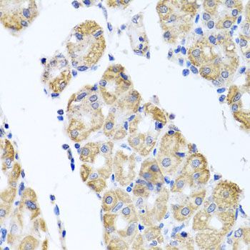 Immunohistochemistry - GLS Polyclonal Antibody (144-03885)
