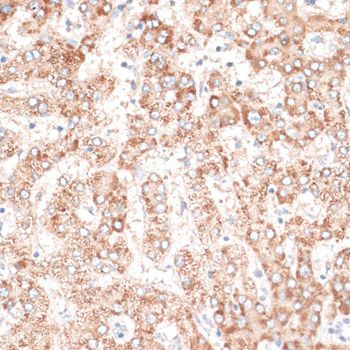Immunohistochemistry - EGFR antibody (144-02069)
