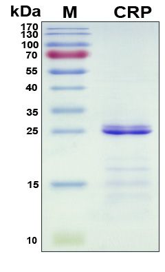 SDS-PAGE