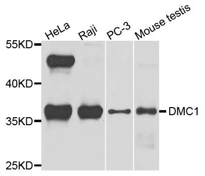 Western blot - DMC1 Polyclonal Antibody (144-04491)